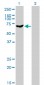 PAPSS2 Antibody (monoclonal) (M07)